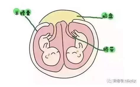 双胎及联体胎-中国女性百科-医学