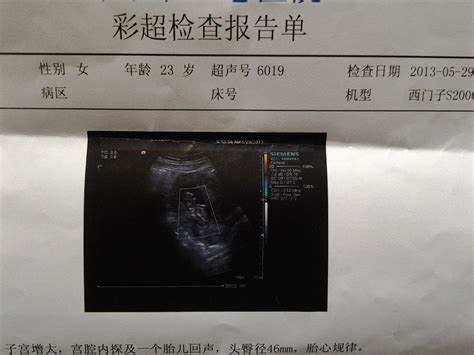 医院低价出售二手彩超_二手回收_废旧网Feijiu.net