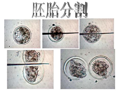 第一节 胚胎时期面部的发育过程-儿科学-医学