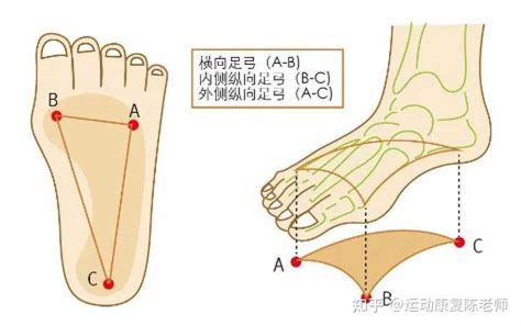 第八节 足弓-足踝常见病诊治与护理-医学