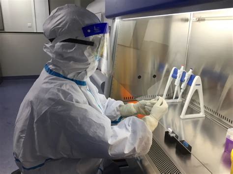 【新进展】于晓波合作团队开发国际首个新冠病毒全蛋白质组血液抗体检测多肽芯片-检验-转化医学网-转化医学核心门户