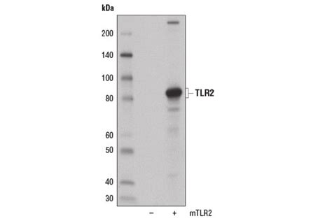 Toll-like Receptor 2 (E1J2W) Rabbit mAb | Cell Signaling Technology
