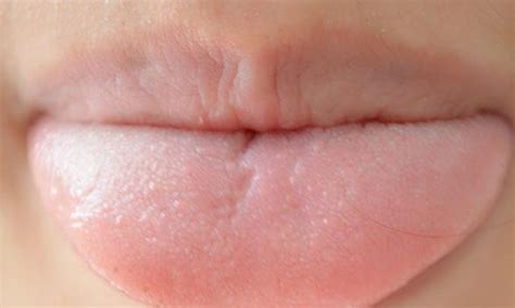 舌头无缘无故发麻? 或与这4种疾病有关, 别当作小事!|舌头|症状|疾病_新浪新闻