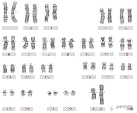 人类细胞染色体为46条是谁发现的？_蒋有兴_遗传学_瑞典隆德大学