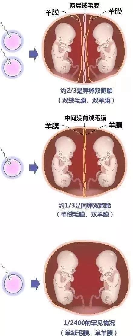 一、双胎-人体解剖学与组织胚胎学-医学