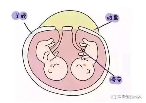 什么是胎盘前置，应该怎么办？ - 知乎