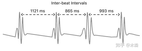 心率过快图片,心率加快图片,正常的心率曲线图(第4页)_大山谷图库