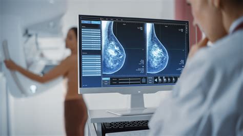 乳房檢查 | 2D 及3D乳房造影檢查 - 醫專薈婦科資訊中心