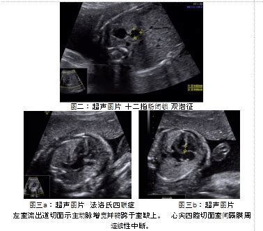 资料下载：胎儿畸形产前超声诊断学(李胜利).pdf