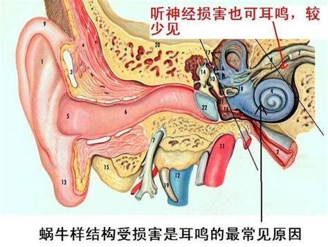 【德诚培训·助听器验配师】耳鸣是什么原因引起的 六个方法治疗耳鸣