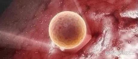 试管婴儿胚胎移植是怎样的过程？ - 知乎