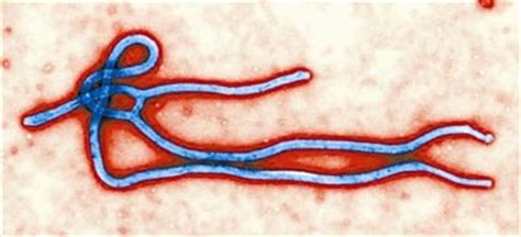埃博拉 - 快懂百科