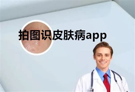 扫一扫图片识别皮肤病app有哪些 能够扫描识别皮肤病的软件合集_豌豆荚