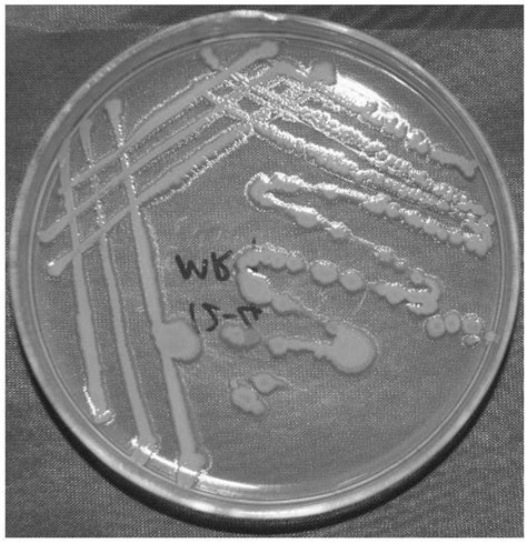 一株高效拮抗向日葵菌核菌的细菌菌株YC16的筛选及其作用效果研究