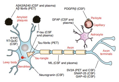 神经退行性变基因 WDR45 将铁蛋白吞噬受损与铁积累联系起来,Journal of Neurochemistry - X-MOL