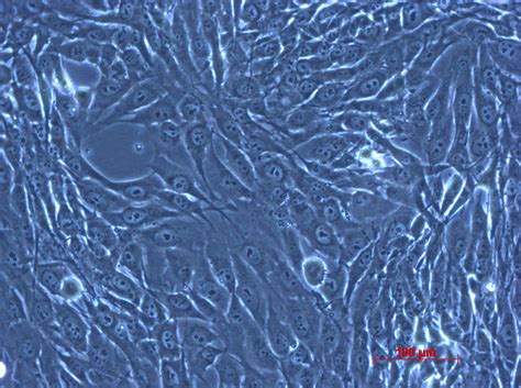 MG-63细胞ATCC CRL-1427细胞 MG63人骨肉瘤细胞株购买价格、培养基、培养条件、细胞图片、特征等基本信息_生物风