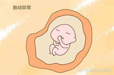 孕期胎儿缺氧有哪些表现？怎么预防胎儿宫内缺氧？ - 知乎