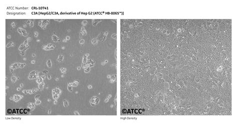 DU4475细胞ATCC HTB-123细胞 人乳腺上皮细胞株购买价格、培养基、培养条件、细胞图片、特征等基本信息_生物风
