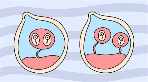 同卵双胞胎和异卵双胞胎在母体内如何成长