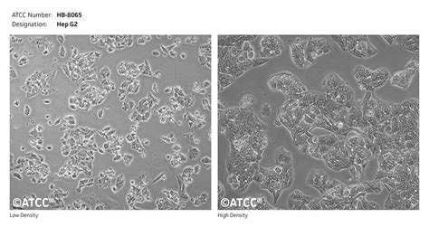 Hs 746.T细胞ATCC HTB-135细胞 Hs746T人胃癌细胞株购买价格、培养基、培养条件、细胞图片、特征等基本信息_生物风
