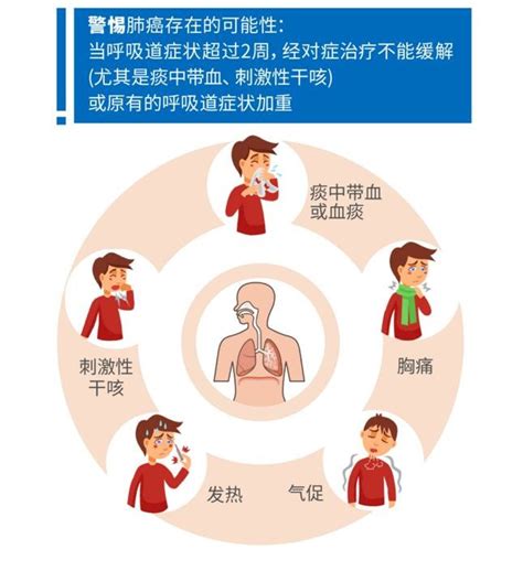 肺癌的常见早期症状，高危人群一定要警惕