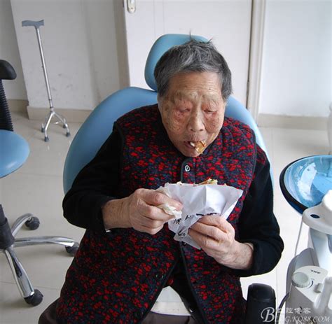 老奶奶镶牙日记-丽水牙医刘庆的博客-KQ88口腔博客