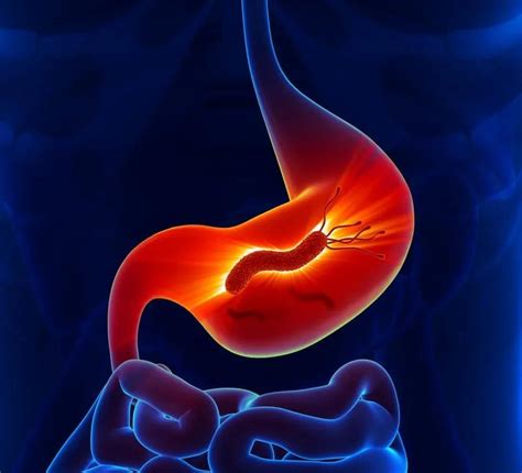 胃酸反流一定是胃酸过多吗？一起来了解我们的胃酸_医学界-助力医生临床决策和职业成长