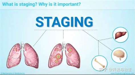 二、肺癌分类-呼吸系统-医学