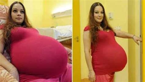 女子怀孕后发现肚子异常巨大，医院检查后吓一跳，破了世界纪录！