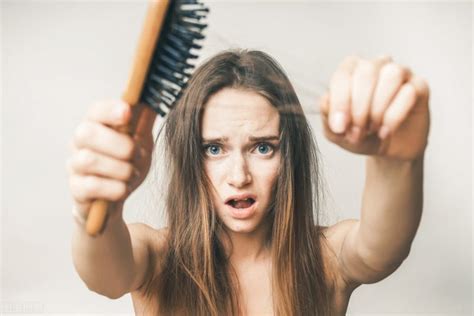 女性严重脱发是什么原因？脱发有哪几种类型 – 生发垂直网