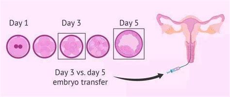 胚胎移植受孕后怎么来推算预产期呢？都大家三种方法，专家都认可-好孕天使(上海)健康管理