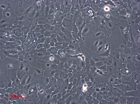 NCl-H460细胞ATCC HTB-177细胞 H460人大细胞肺癌细胞株购买价格、培养基、培养条件、细胞图片、特征等基本信息_生物风