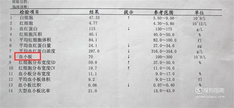 血常规检验报告单模板（八篇） - 范文118