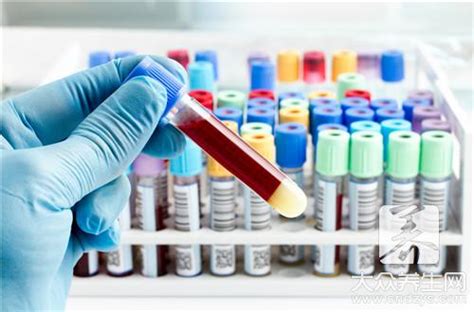 血生化检查项目、标准和临床意义 - 料事通ivdmat