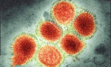 人类历史上最可怕的十大病毒：天花病毒、埃博拉病毒、狂犬病病毒