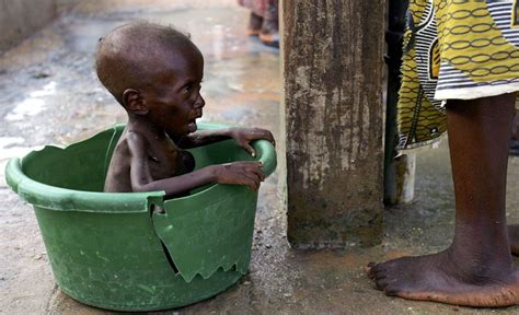 全球10亿人生活在极端贫困线下，8.52亿人处饥饿状态