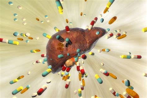 药物引起的肝毒概念图高清图片下载-正版图片507446006-摄图网
