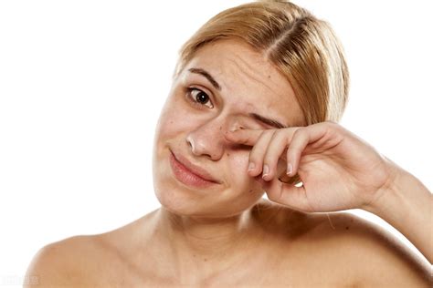 眼角发痒是什么原因（总感觉眼角痒是怎么回事？帮你分析了4个原因，要对症治疗） | 说明书网