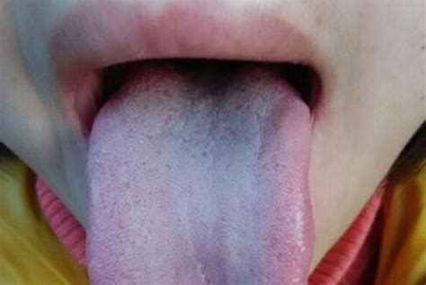 舌头易麻木变紫色？都怪血管堵，4件事可让血管通畅血脂不留