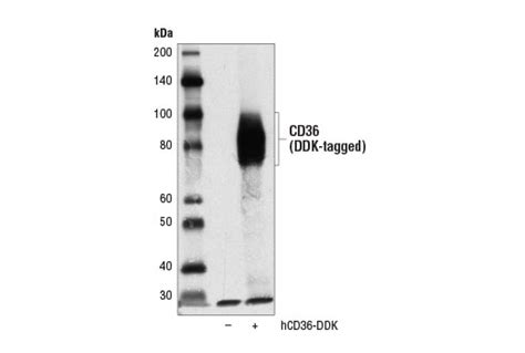 项目文章 IF 38 | CD36 癌相关成纤维细胞通过分泌巨噬细胞迁移抑制因子为肝细胞癌提供免疫抑制微环境-上海生物芯片有限公司