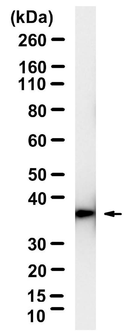 Anti-Fibrillin-1 Antibody, clone 6C19 ZooMAb® Rabbit Monoclonal