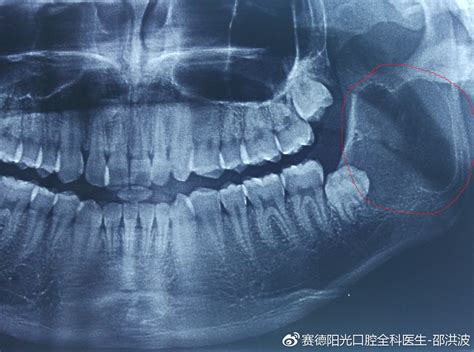 口腔解剖（Oral Anatony）_《口腔科学》在线阅读_【中医宝典】