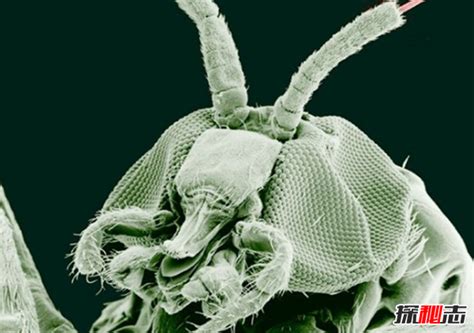 人体寄生虫有哪些种类?寄生虫对人体的十大危害_探秘志