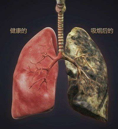 健康生活，远离烟草