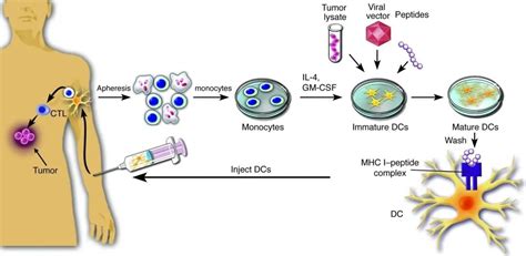 武大和华科团队联合发明激活DC细胞的抗癌疫苗_HELA-Exos_肿瘤_抗原
