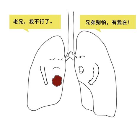 关于肺癌，看完你就不用再慌了！