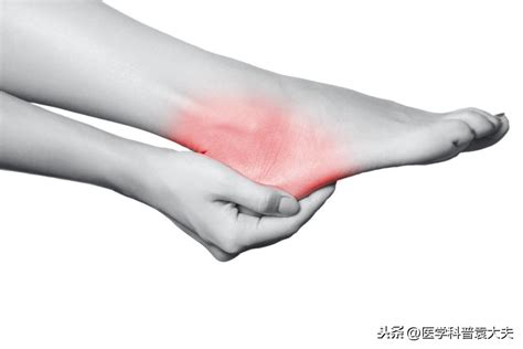 脚后跟经常疼痛要当心，预示5种疾病风险！ - 知乎