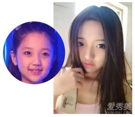 10位韩国童星长大了，经过岁月的雕琢谁变化最大？_腾讯视频
