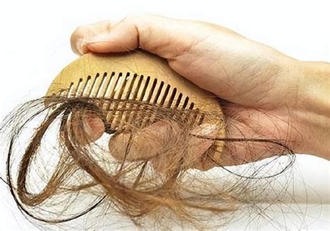 经常掉头发是什么原因？掉头发很厉害怎么办_360新知
