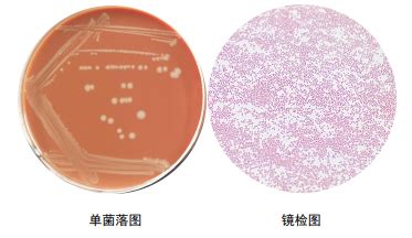 流感嗜血杆菌 BNCCBNCC259887 微生物菌种|北纳生物